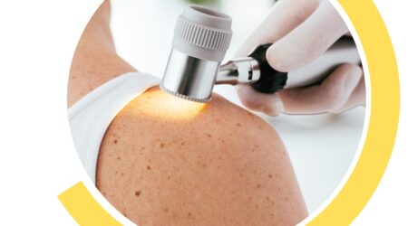 Campagna di Prevenzione del MELANOMA | aprile 2026